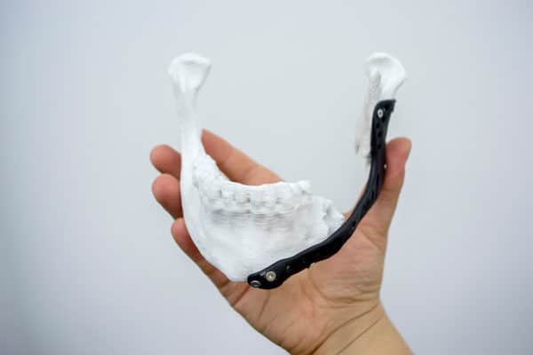 3D-printed prototype medical/dental/surgical device